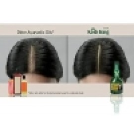 kesh king ayurvedic scalp and hair oil 300ml